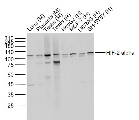 缺氧诱导因子2α/EPAS1重组兔单抗