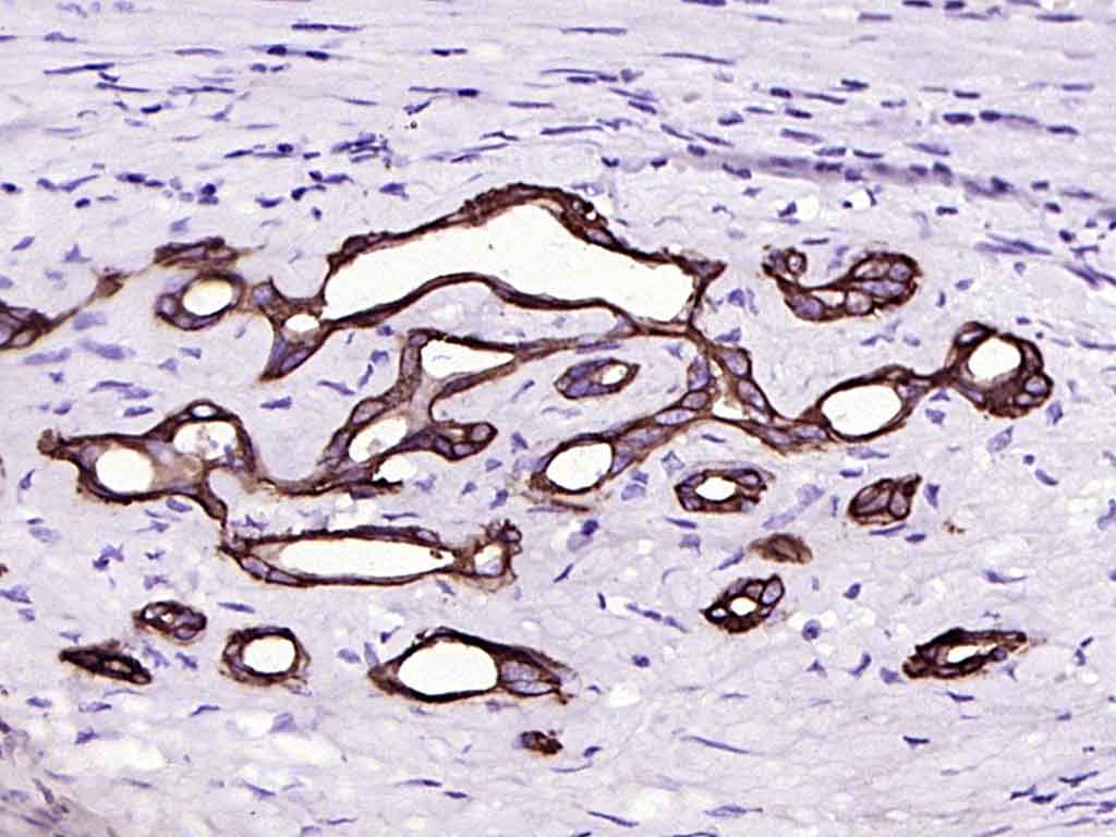 细胞色素cP450 CYP26A1重组兔单抗