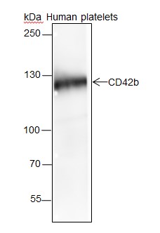 血小板糖蛋白GPIb（CD42b）重组兔单抗