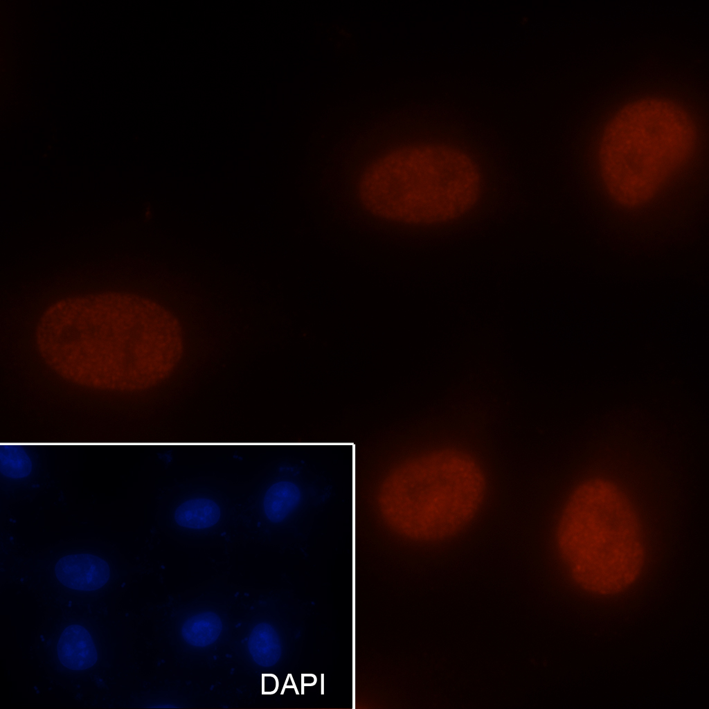 乙酰化组蛋白H3K27单克隆抗体-bsm-60051M
