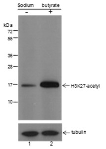 Acetyl-Histone H3 (Lys27) Mouse mAb (一抗) - WB,IHC-P,IHC-F,IF,ICC/IF | Bioss