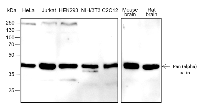 泛肌动蛋白重组兔单抗