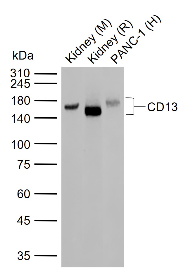 CD13重组兔单抗