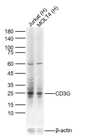 CD3G Recombinant Rabbit mAb (一抗) - WB,IHC-P,IHC-F,IF,ICC/IF | Bioss