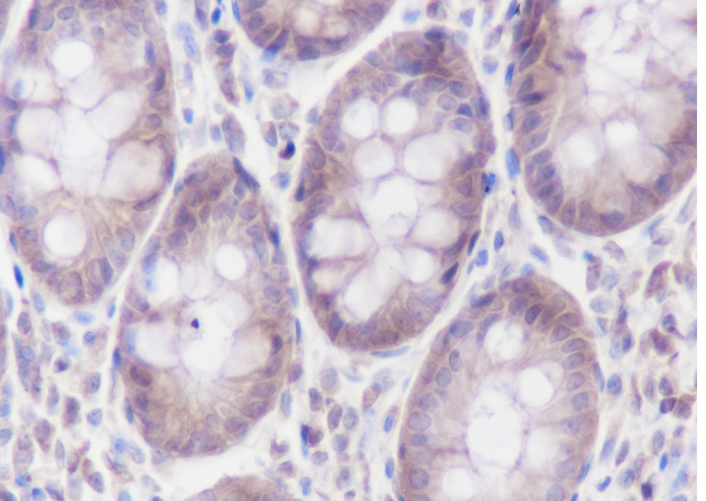 α-辅肌动蛋白4重组兔单抗-bsm-60423R