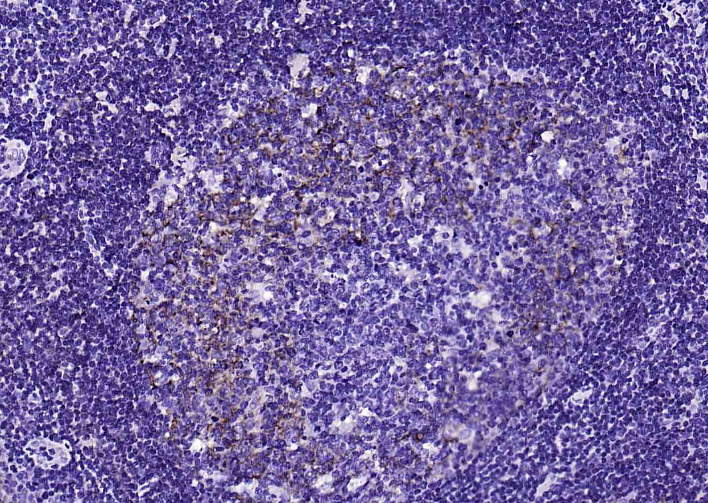 CD23 Recombinant Rabbit mAb (一抗) - IHC-P,IHC-F,IF | Bioss