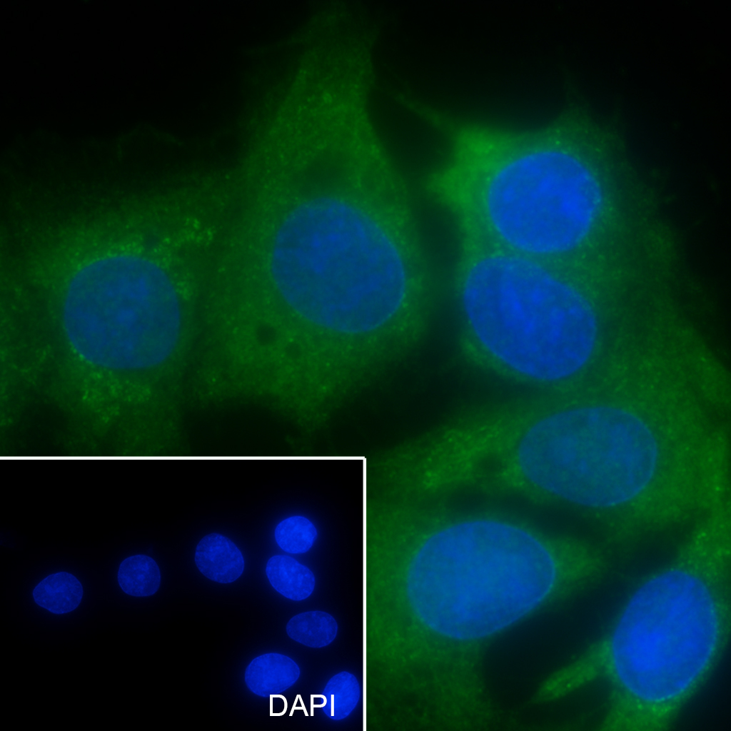SMYD2 Recombinant Mouse mAb (一抗) | Bioss