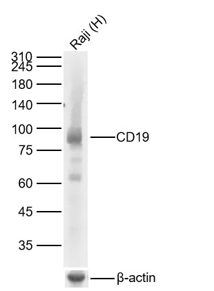 CD19 Recombinant Rabbit mAb (一抗) - WB,IHC-P,IHC-F,IF | Bioss