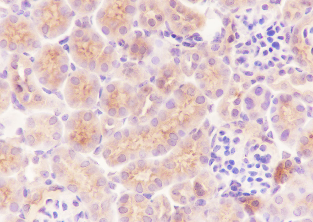 T淋巴细胞激活蛋白重组兔单抗-bsm-60617R