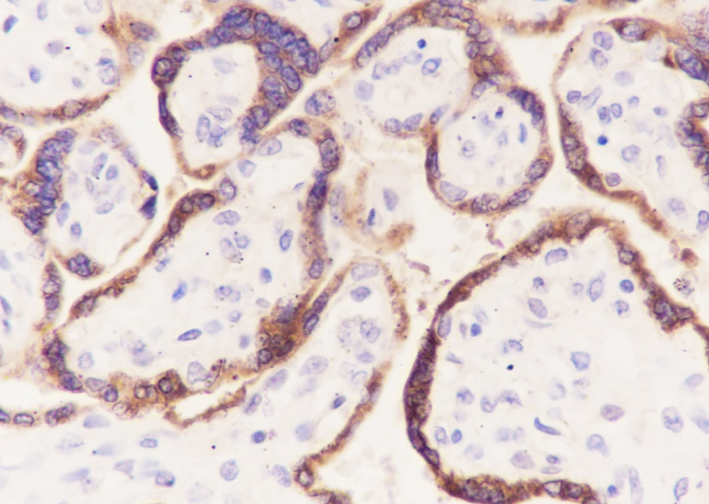 促甲状腺激素α重组兔单抗
