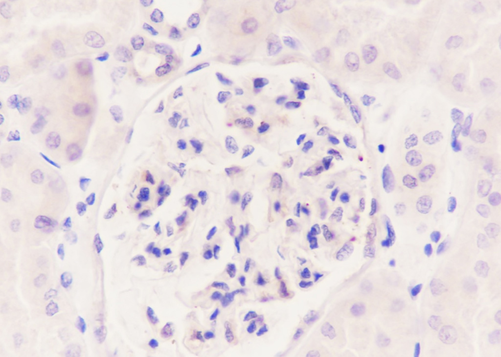 促甲状腺激素α重组兔单抗