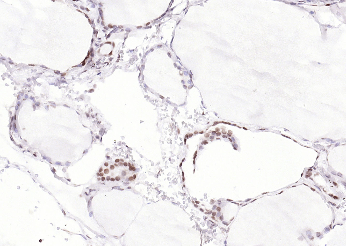 PAX8 Recombinant Rabbit mAb (一抗) | Bioss