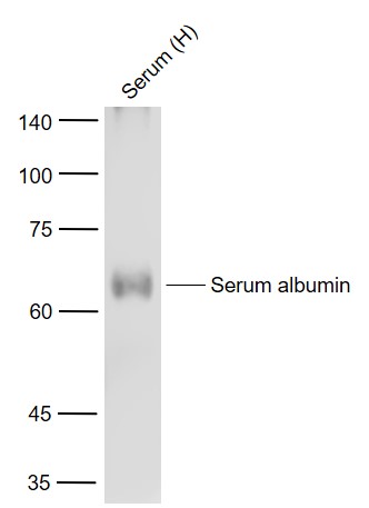 Albumin Mouse mAb, Animal-free, Loading Control (一抗) - WB | Bioss