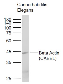 Beta Actin (CAEEL) Mouse mAb, Loading Control (一抗) | Bioss